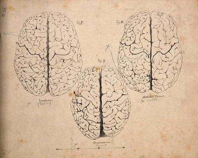 Gyri of the brain: three figures, one of a European, one of the "Hottentot Venus", and one of an African Bushwoman
