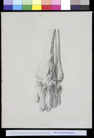 Hand and lower arm (ulna and radius)