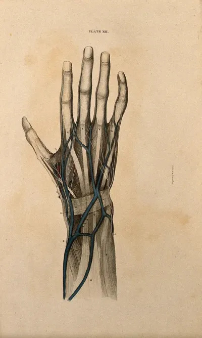 Hand: dissection, with blood vessels and nerves indicated in red and blue
