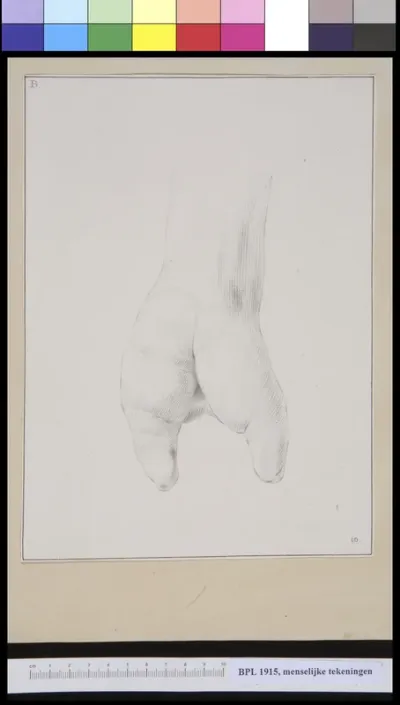 Hand with two fingers