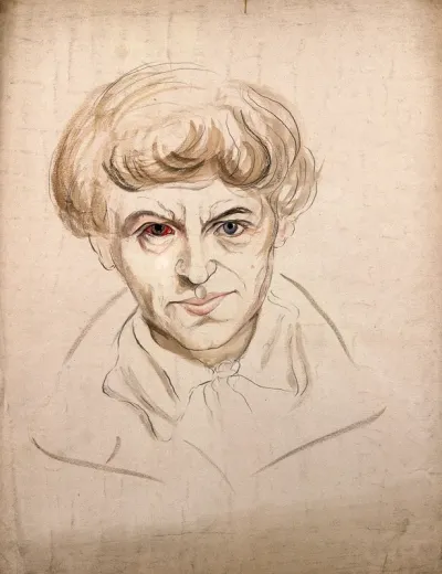 Head of a man with a disease affecting his eye