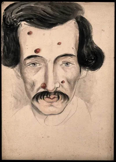 Head of a man with a disease affecting his face