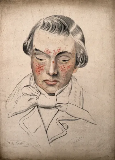 Head of a man with a severe disease affecting his face