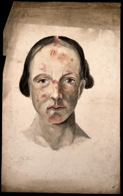 Head of a woman with a disease affecting her face