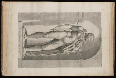 Heracles with the Infant Telephos