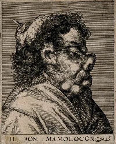 Herr von Mamolocon, a character with a grotesque face