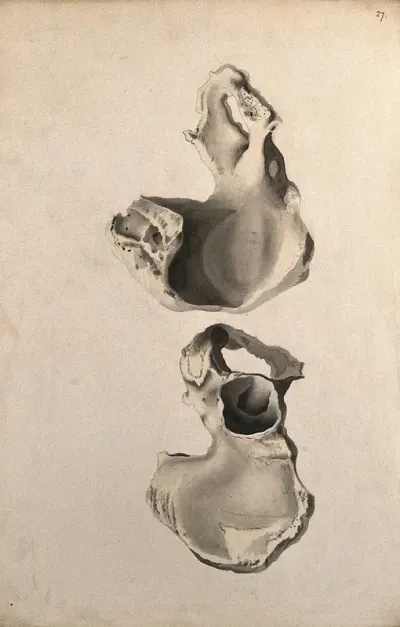 Hip bones: two figures