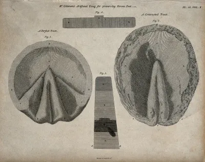 Horses' hooves, seen from below: four figures showing both perfect and contracted feet, demonstrating Mr