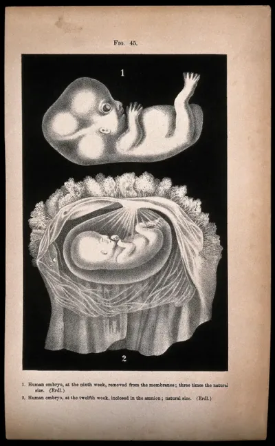 Human embryo, two figures: above, the foetus at nine weeks, below, the foetus at twelve weeks, shown enclosed in the amnion
