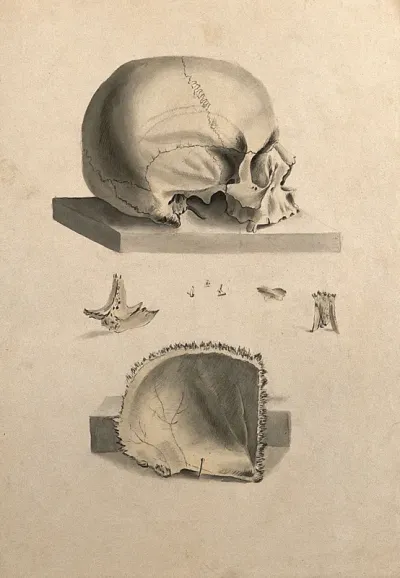 Human skull: six figures showing sections and an entire skull
