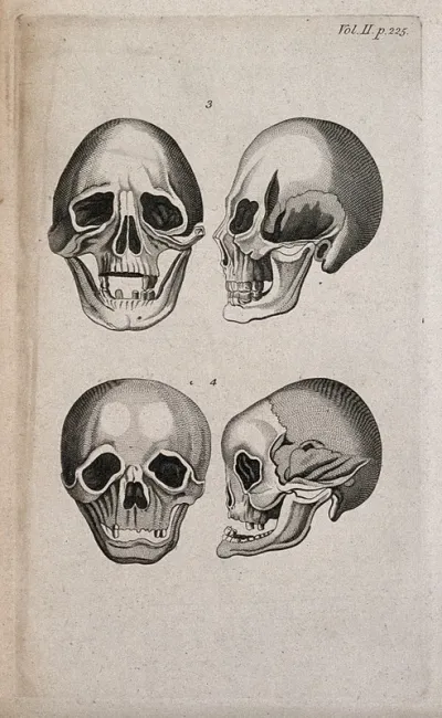 Human skulls: four figures