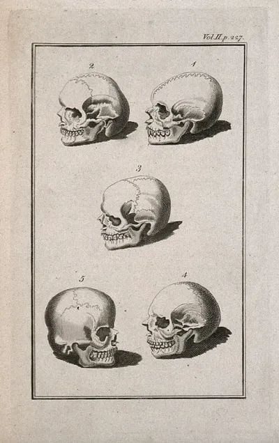 Human skulls showing sutures: five figures