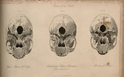 Human skulls: three figures showing the skulls of an African, a Native American and a Chinese, seen from beneath