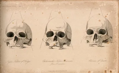 Human skulls: three figures showing the skulls of an African, a Native American and a Chinese