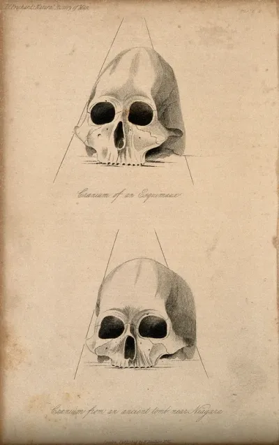 Human skulls: two figures showing a skull of an Inuit person and a skull from a tomb near Niagara
