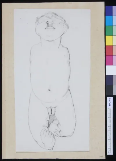 Infant with several deformations