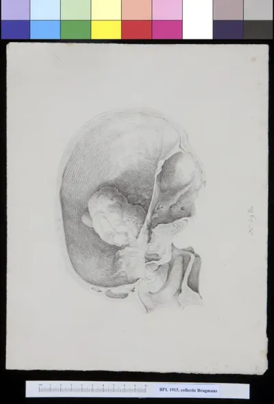 Interior of skull