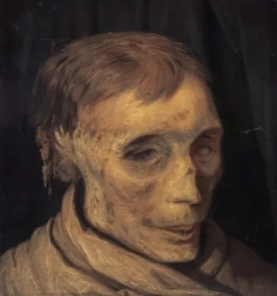 James Hepburn, 4th Earl of Bothwell, c 1535 - 1578. Third husband of Mary, Queen of Scots (Study of mummified head)