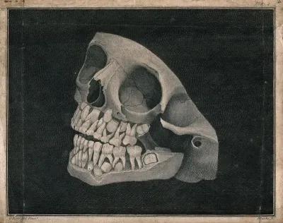 Jaw and part of skull of an animal