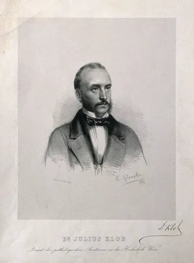 Julius Klob. Lithograph by C. Glinski, 1859