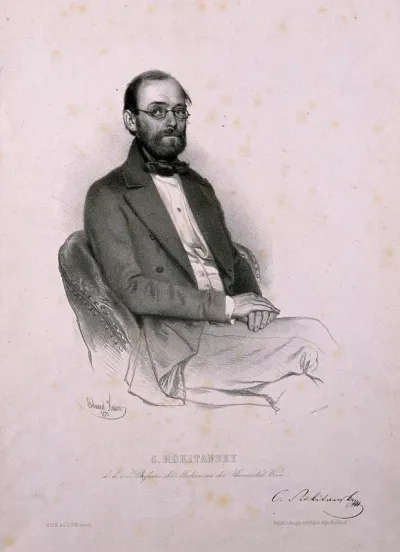 Karl, Freiherr von Rokitansky