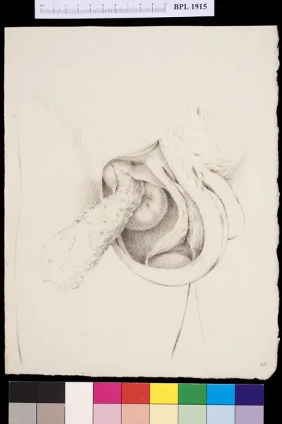 Kidneys, bladder