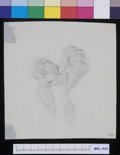 Kidneys with cysts