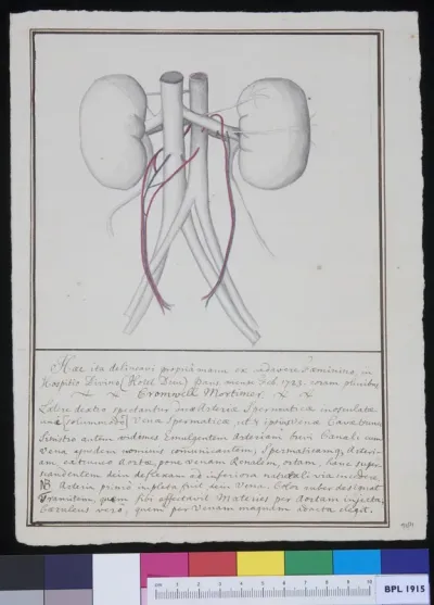 Kidneys with handwritten comment