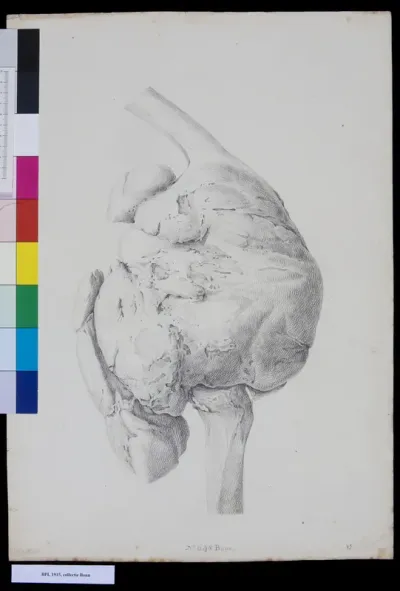 Knee