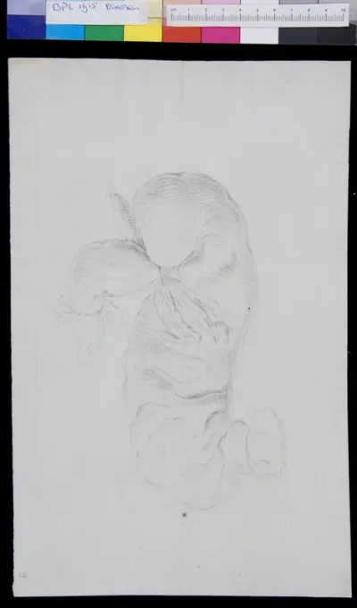 Large intestine
