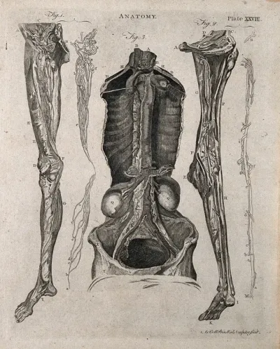 Lymphatics: five figures showing the lymphatic vessels of dissected legs and a torso
