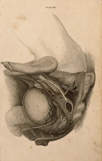 Male pelvis and genitals: dissection, with blood vessels and nerves indicated in red and blue
