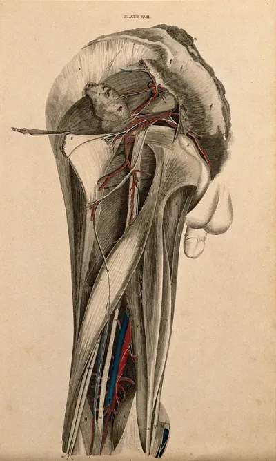 Male pelvis and thigh: dissection, with blood vessels and nerves indicated in red and blue