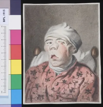 Man with an infection in his face