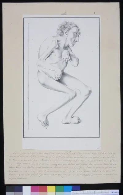 Man with torsioned vertebrae