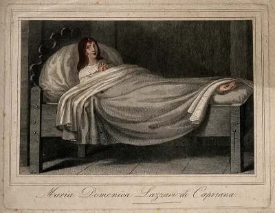 Maria Domenica Lazzari (Lazzeri), a woman displaying stigmata