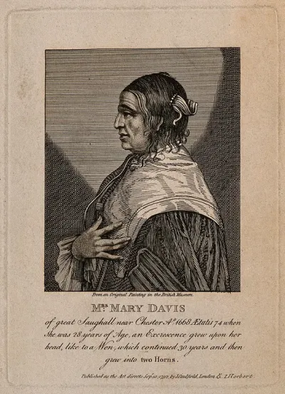 Mary Davis, a woman with horns, aged 74