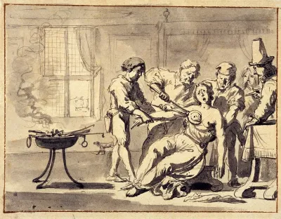 Mastectomy. Drawing attributed to a Dutch artist, 17th century