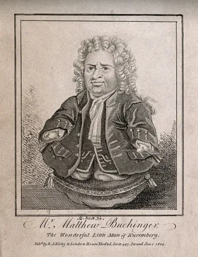 Matthias Buchinger, a phocomelic man