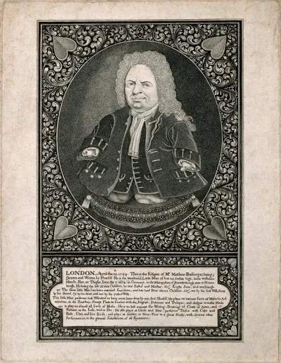 Matthias Buchinger, a phocomelic man