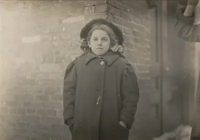 Mery Horn, a hunchback condition aggravated by the heavy load of papers she carried. Hartford, Connecticut, March 1909
