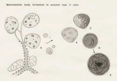 Multilamellar body formation in prenatal type II cells