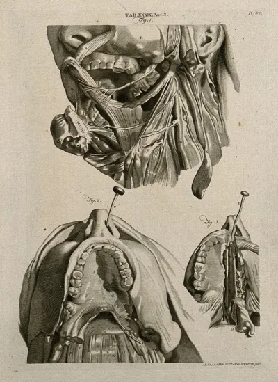 Muscles of the tongue, mouth and throat, with interconnections to the nose: three figures
