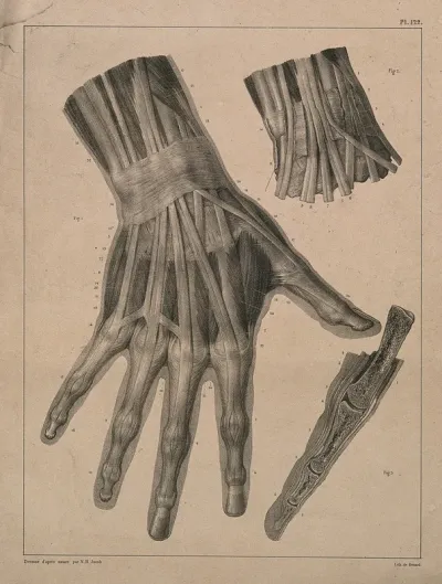 Muscles, tendons and bones of the hand: three figures