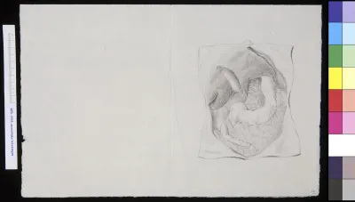 Open abdomen