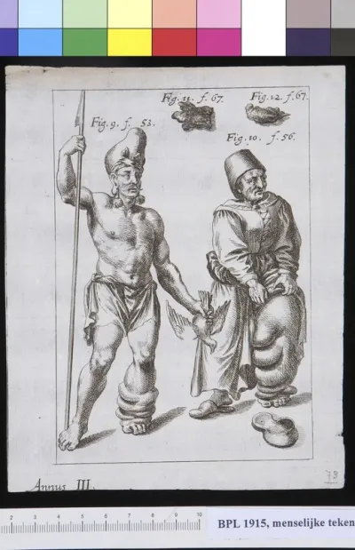 (Oriental?) man and woman with elephantiasis in one leg