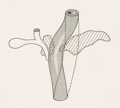 Pancreatic development of an embryo