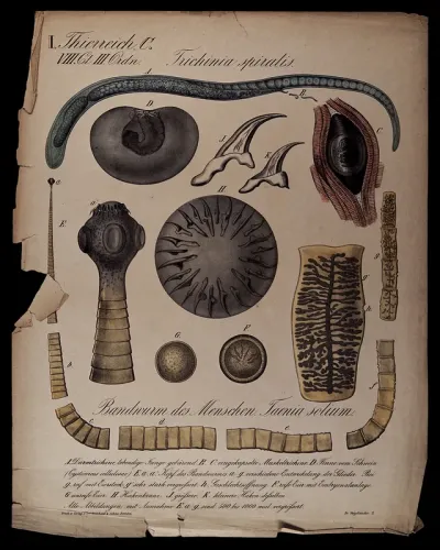 Parasites found in the human body: eleven figures, including a tapeworm, trichina and bladderworm