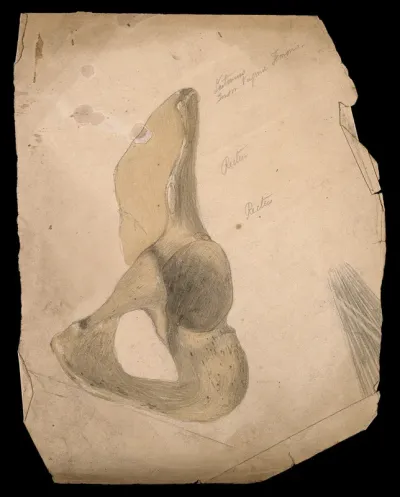 Part of the pelvis: the hip bone