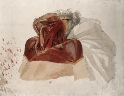 Partially dissected neck, shoulders and chest of a man, side view, showing the deltoid and pectoralis muscles